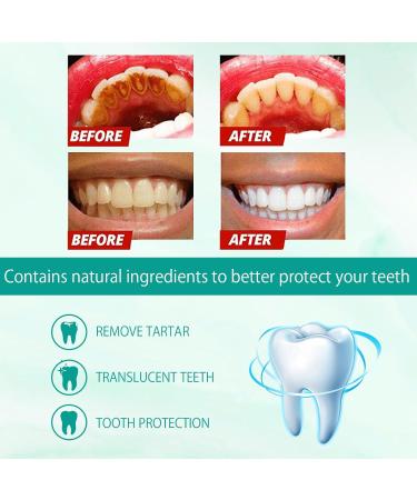 Teeth Whitening Toothpaste Foam 60ml | Bright White Teeth & Stain Removal - Color Correction for Coffee & Smoking - Buy Online on GoSupps.com