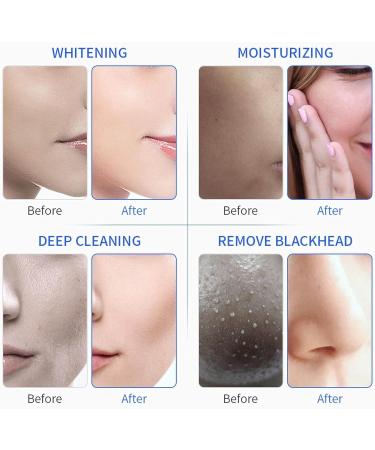 Water Oxygen Jet Beauty Machine | Electric Facial Care Tool for Deep Clean & Blackhead Removal - Buy Online on GoSupps.com