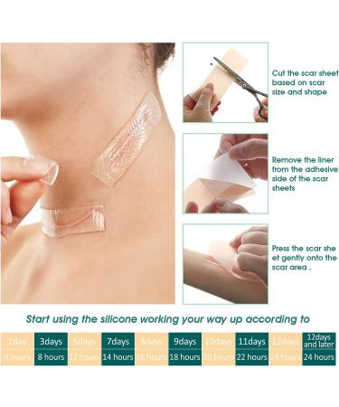 Silicone Scar Removal Sheets for C-Section Surgery, Burns, Acne, Keloids & Stretch Marks - Washable & Reusable - Effective on Old & New Scars - 4 Pack - Buy Online on GoSupps.com