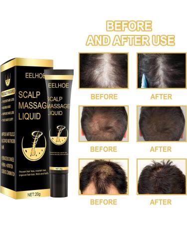 Herbal Hair Growth Serum - Anti Hair Loss Roll-On for All Hair Types | Biotin & Massage Ball | Rejuvenate & Regrow Hair Naturally - Buy Online on GoSupps.com