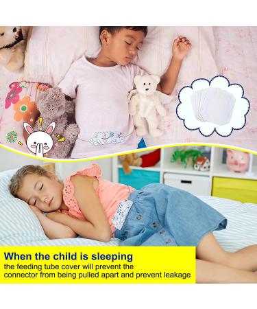 4 Pack Soft Feeding Tube Port Covers with Hoop and Loop Strap - Reusable for Kids and Adults - Buy Online on GoSupps.com