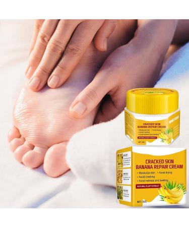  smashing smashing Chapped Feet Repair Cream | Banana Foot Repair Skin Healing Moisturizing 30g Chapped Heel Moisturizer Foot Repair for Removing Dead Skin - Buy Online on GoSupps.com