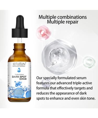 Melasma Treatment Serum with 4-Butylresorcinol, Kojic Acid & Salicylic Acid - Buy Online on GoSupps.com