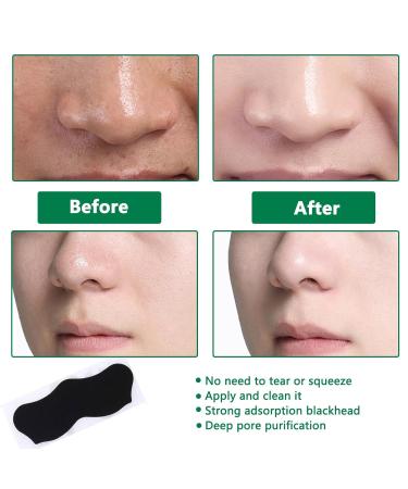 80 Blackhead Remover Strips - Natural Bamboo Coal Nose Pore Cleansing & Acne Stick Effective Blackhead Treatment - Buy Online on GoSupps.com