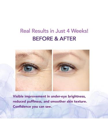 Caffeine Eye Cream for Dark Circles and Puffiness Retinol Under Eye Brightening Cream for Wrinkles Fine Lines and Tired Eyes - Buy Online on GoSupps.com