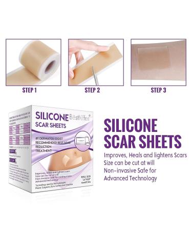 Silicone Scar Tape Roll - Professional Scar Removal Strips - 6 Month Supply - Medical Grade Treatment for C-Section, Burn, Keloid, Acne - Reusable & Effective - Buy Online on GoSupps.com