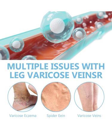 ITECFREELY Varicose Veins Cream Improve Blood Circulation Varicose Veins Care Fast Soothe Cream for Legs Blue - Buy Online on GoSupps.com