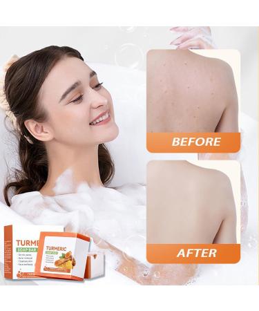 Turmeric Soap Turmeric Natural Soap Bar Turmeric Handmade Soap for Face & Body acne soap for Blackheads Remover Hyaluronic Acid for Deep Cleansing and Skin Moisturising with a Mesh Soap Pouch - Buy Online on GoSupps.com