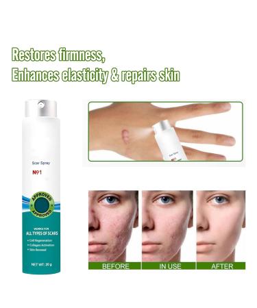 Heal Scar Care Spray | Advanced Formula for All Scar Types | 80g - International Shipping Available - Buy Online on GoSupps.com