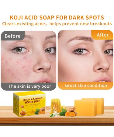 IREV Koji Acid Soap & Honey Turmeric Soap for Dark Spots | Acne Face Wash & Deep Cleansing Soap | Gentle Turmeric Bath Bars - 200g - Buy Online on GoSupps.com