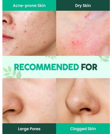 Glam Up Calming Matcha Tea Tree Clay Mask - Vegan Face Mask for Acne Treatment, Deep Cleansing & Gentle Exfoliation - 125ml - Buy Online on GoSupps.com