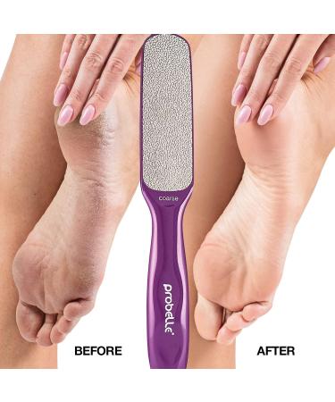 Probelle Double Sided Multidirectional Nickel Foot File Callus Remover - Immediately Reduces calluses and Corns to Powder for Instant Results Safe Tool (Purple) - Buy Online on GoSupps.com