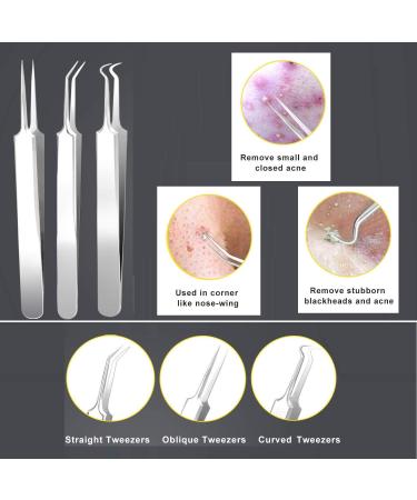 Blackhead Remover Kit Curved Tweezer Blackhead Removal Tools Spot Remover Tools Professional Pimple Comedone Extractor Zit Popper for Nose Face (pink) - Buy Online on GoSupps.com