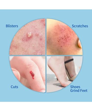 Hydrocolloid Dressings 10x10 cm - Waterproof Adhesive Wound Care for Light Exudate Acne & Bubbles - 10 Pieces 1.2 mm Thick - Buy Online on GoSupps.com