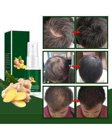 Ginger Hair Growth Serum - Nourishing Spray for Men and Women | 1pc - Buy Online on GoSupps.com