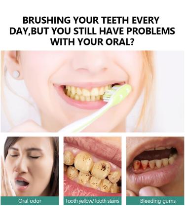 Probiotics Bright Whitening Teeth Mousse - Herbal Oral Repair for Gum Health & Fresh Breath - Buy Online on GoSupps.com