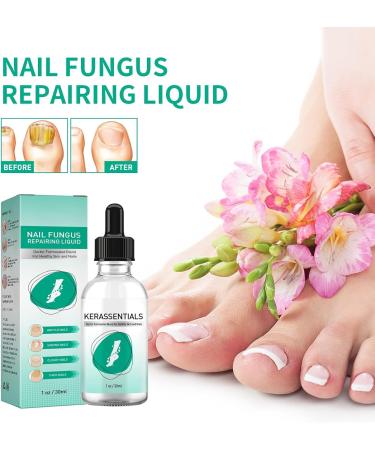 dhcprj Kerassentials Toenail Fungus Treatment Oil Toenail & Nail Care Solution Safe & Effective Repairs & Renewals Easy to Use Yellow Liquid - Buy Online on GoSupps.com
