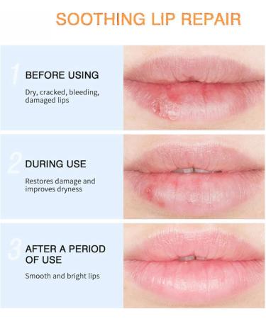 Lip Balm Propolis Lip Scrub Gel Lips Exfoliating Scrub Gel Lip Scrub Exfoliator Moisturizing Repair Lip Dead Skin Gel Lip Lightening for Dark Lips Nursing Lip Dead Skin Gel Overnight Lip Treatment - Buy Online on GoSupps.com