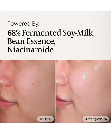 aruen Fermented Tofu Collagen Serum 68% Fermented Soy Milk with Niacinamide & Hyaluronic Acid Korean Hydrating Face Serum for Firming, Radiance & Skin Barrier Care (1.01 fl oz / 30ml) - Buy Online on GoSupps.com
