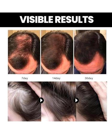 Hair Repair Oil for Women 60ml Natural Oil for Nourishing Dry Hair | Dry Hair Accessories for Home Travel Vacation Trip - Buy Online on GoSupps.com