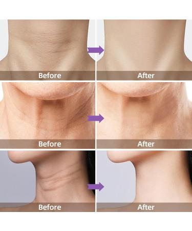 Neck Firming Cream with 5% Collagen Complex Anti Aging Neck Cream for Tightening and Wrinkles for An Even Skin Tone and Neck Lift 50ml - Buy Online on GoSupps.com