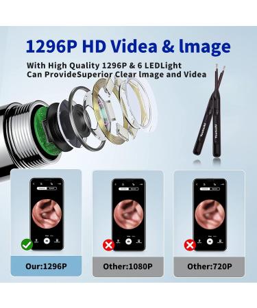 Premium Ear Wax Removal Kit with HD Camera & 6 LED Lights - Rechargeable Ear Cleaner for Adults & Kids - Compatible with iOS & Android - Buy Online on GoSupps.com
