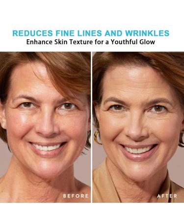 Botox Stock Solution Facial Serum - Anti-Aging Instant Face Lift Tightens Skin Reduces Fine Lines & Wrinkles Hydrates & Boosts Collagen for Women - Buy Online on GoSupps.com
