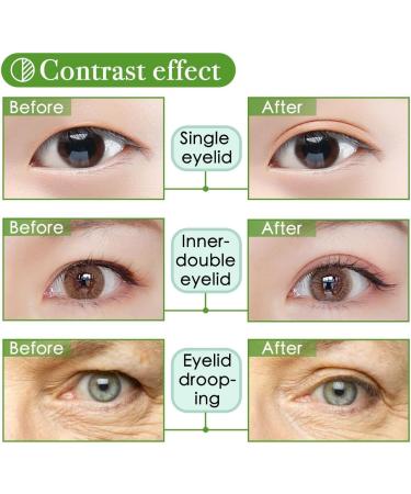 400pcs/200 Pairs Invisible Large Size Single-Sided Eyelid Tapes Stickers Medical-use Fiber Eyelid Lift Strips Perfect for Hooded Droopy Uneven Mono-eyelids - Buy Online on GoSupps.com