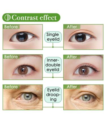 200 Pairs Natural Invisible One Side Eyelid Tape Stickers | Waterproof Breathable Self-Adhesive Eye Lift Strips - Instant Results, No Surgery | Ideal for Uneven, Droopy, Hooded Eyelids - Buy Online on GoSupps.com