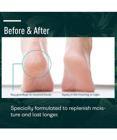  ccuzs Foot Creams and Lotions Softening Skin Formule 50 g Moisturizer Tube Cracked Heel Relieve Gentle Care for Dry Skin Body Legs Men Women Home Skincare Routine Self Care Treatments 1 97 x 1 57 in - Buy Online on GoSupps.com