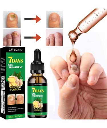 FLLUOUZH 3 Pieces 7 Days Ginger Nail Ginger Nail Treatment Nail Support Nail Care Ginger Nail Growth Serum Ginger Cuticle Care Oil for Nails - Buy Online on GoSupps.com