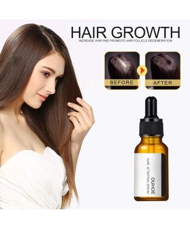 Hair Growth Serum 20ML Anti Hair Loss Hair Growth Essential Oil Fast Hair Growth Serum Hair Loss Treatment (3 pieces) - Buy Online on GoSupps.com