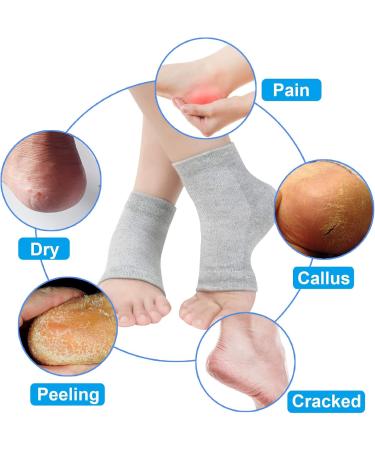 Vented Moisturizing Gel Heel Socks 3 Pairs Toeless Spa Sock for Foot Care Treatment Cracked Heels Dry Feet Foot Calluses (Black) - Buy Online on GoSupps.com