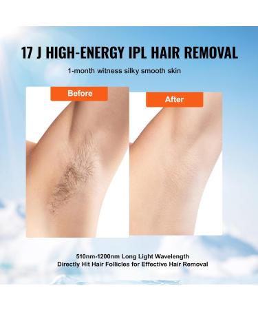 VEVOR IPL Laser Hair Removal Device - 17J Epilator with 510-1200NM Wavelength 5-Stage Intensity 400 000 Light Impulses - Fast & Effective Hair Removal - Buy Online on GoSupps.com