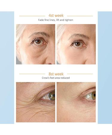  bellv Dark Eye Cream Nourishing Eye Essence Cream Dark Remover 0.8 Fl Oz Hyaluronic Acid Moisturizing Eye Cream Deflating for Daily Use Bellv - Buy Online on GoSupps.com