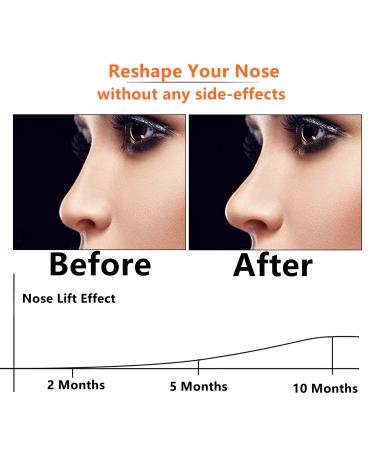 Nose Shaper Clip - Silicone Nose Lifter & Slimming Tool for Beautiful Straight Nose | Rhinoplasty Bridge Corrector for Women (Green - Buy Online on GoSupps.com