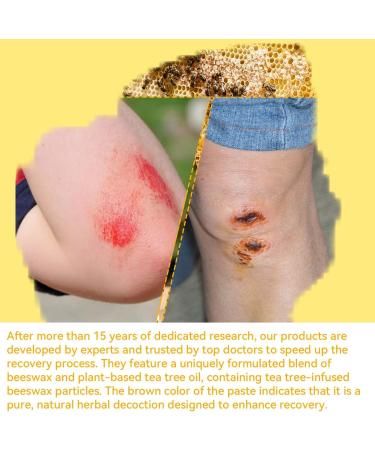 Manuka Honey 5x Accelerated Healing Relief Care Products Advanced Cream for Buttocks Bed Sores Cream Pressure Sores Wounds Ulcers Cuts Scrapes Burns Deep Fast-acting Non-greasy and irritating 4 Ounce (1 pack ) - Buy Online on GoSupps.com