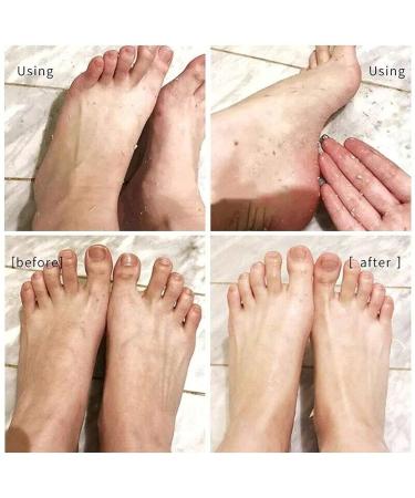 Foot Peeling Spray with Orange Oil Exfoliate Dead Skin & Calluses Fast | Hydrating & Nourishing Formula - Buy Online on GoSupps.com