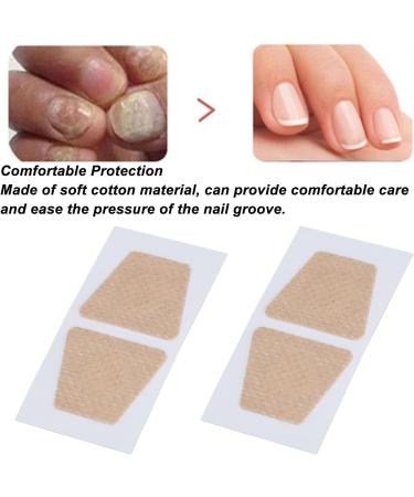 Saluaqui 20Pcs Toenail Corrector Patch - Breathable Ingrown Toenail Removal for Home & Outdoor Use - Buy Online on GoSupps.com