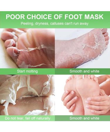 2 Pairs Foot Peeling Mask Exfoliating Foot Mask Exfoliating Peeling Foot Mask for Foot Care Very Dry and Damaged Feet Mask Foot and Callus Peeling Foot Care (Aloe Vera) - Buy Online on GoSupps.com