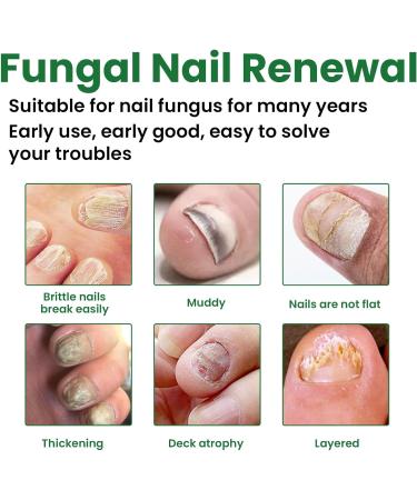 MrCuvaryas Nail Serum for Toenails Extra Strong - Buy Online on GoSupps.com