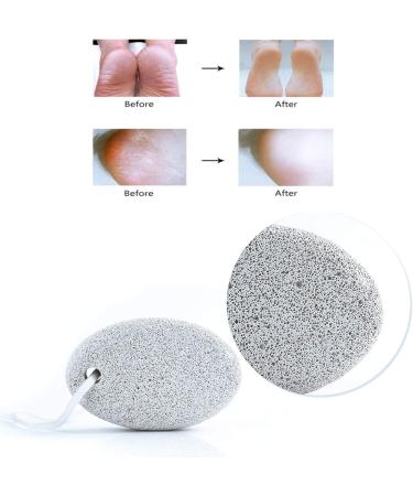 Flzone Pumice Stone Set for Pedicure | 2-Piece Lava Stone Foot Care Tools | Remove Hard Skin for Feet & Hands - Buy Online on GoSupps.com