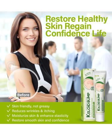 iTecFreely Keloid Scar Treatment for Nose & Belly Piercings - Silicone Scar Gel for Stretch Marks, Burns & Surgery Scars - Buy Online on GoSupps.com