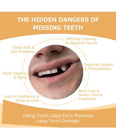 Partial Dentures - Dentures for Missing Teeth & Gaps - Lightweight & Unbreakable Replacement Teeth for Men & Women (1 Tooth) - Buy Online on GoSupps.com