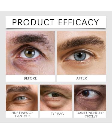 Rubu22a Eye cream cream for men and women against dark circles puffiness and wrinkles temporary eye firming with easytowear formula antiaging eye cream for fine lines 2 - Buy Online on GoSupps.com