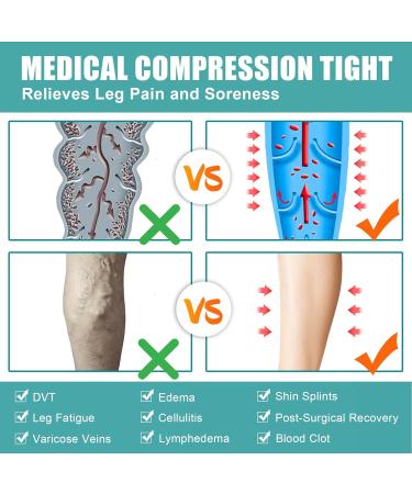 Evolyline Medical Compression Pantyhose for Women & Men 20-30mmHg Footless Graduated Support Tights Compression Pantyhose Opaque Compression Socks Stockings for Varicose Veins Edema Flight Nursing Black S - Buy Online on GoSupps.com