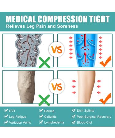 Evolyline Medical Compression Stockings for Women & Men - Long 20-30 mmHg Class II Tights - International Shipping Available - Buy Online on GoSupps.com