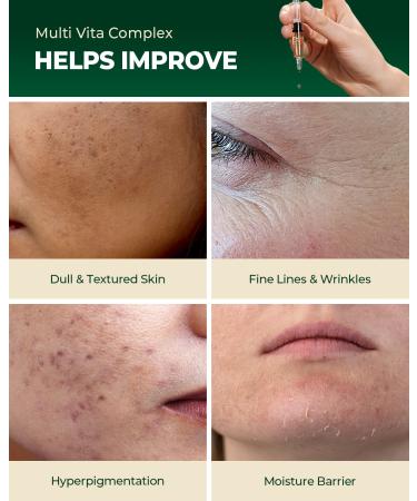 Glam Up x GD11 Hemp & Hyaluronic Acid Anti-Aging Serum 1.18 Fl Oz - Hydrating Brightening Facial Serum with Vitamin Stem Cells - Pack of 1 - Buy Online on GoSupps.com