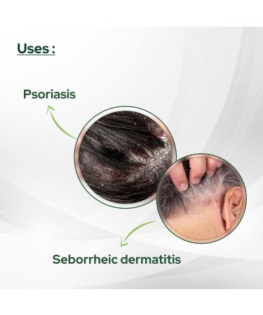 Salve Coal Tar Soap 75gm 2.64oz with Tea Tree & Aloe Vera | Relieves Dry Itchy Skin | Pack of 2 - Buy Online on GoSupps.com