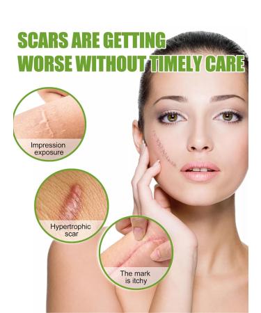 Buy Silicone Scar Sheets - 2 Boxes (1.6 x 60 Roll) for Effective Scar Removal | Reusable Silicone Scar Tape for All Types of Scars - International Shipping Available - Buy Online on GoSupps.com